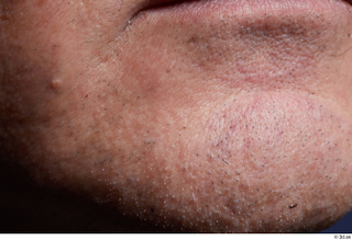 HD Face Skin Owen Martin chin face skin pores skin…